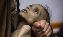 Gazze'de açlık krizi büyüyor! 9 yaşındaki Meryem 10 kiloya düştü