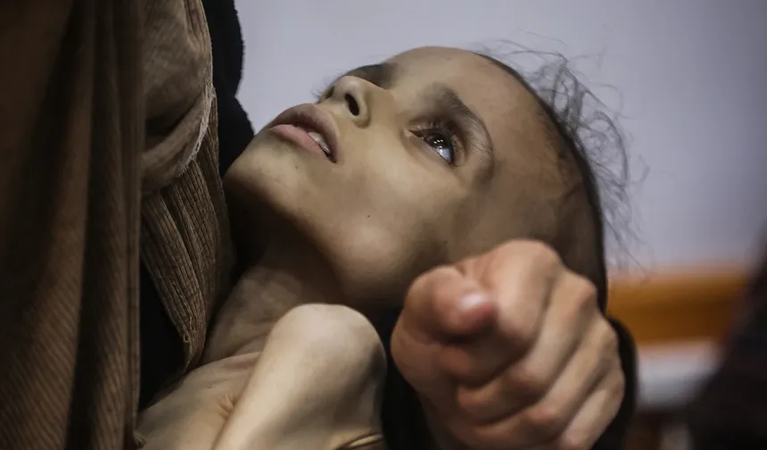 Gazze'de açlık krizi büyüyor! 9 yaşındaki Meryem 10 kiloya düştü